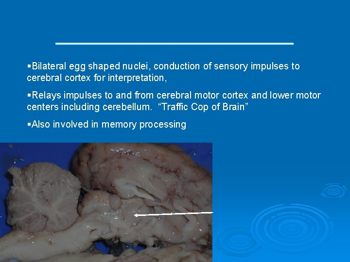 __________ §Bilateral egg shaped nuclei, conduction of sensory impulses to cerebral cortex for interpretation,