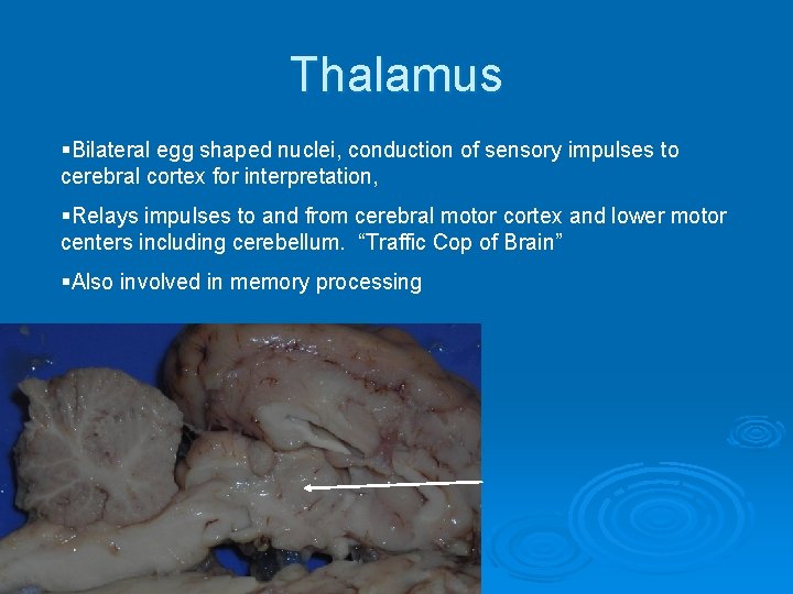 Thalamus §Bilateral egg shaped nuclei, conduction of sensory impulses to cerebral cortex for interpretation,