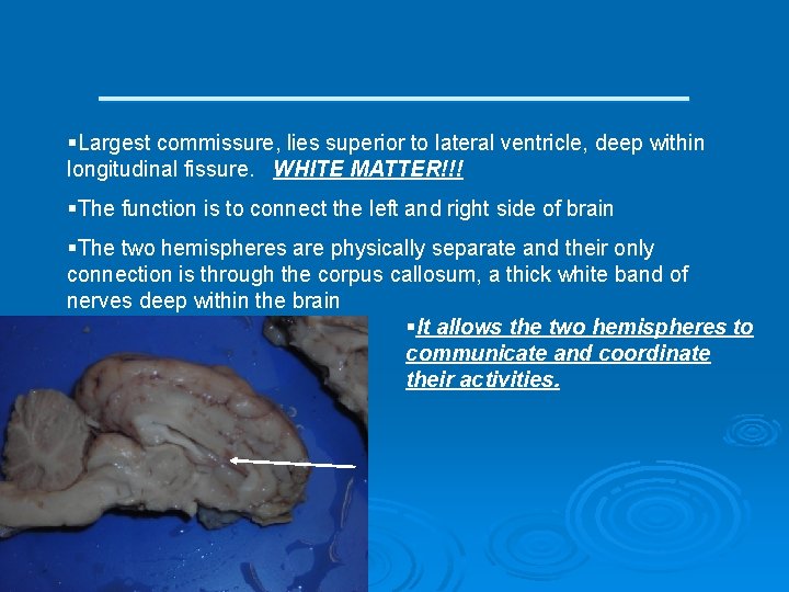 ___________ §Largest commissure, lies superior to lateral ventricle, deep within longitudinal fissure. WHITE MATTER!!!