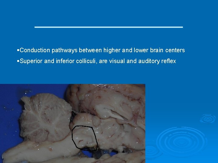 __________ §Conduction pathways between higher and lower brain centers §Superior and inferior colliculi, are