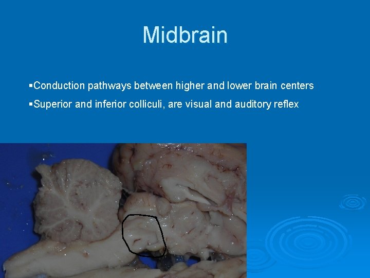 Midbrain §Conduction pathways between higher and lower brain centers §Superior and inferior colliculi, are