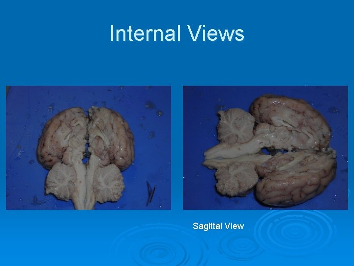 Internal Views Sagittal View 