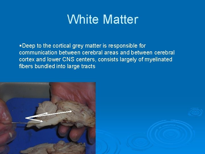 White Matter §Deep to the cortical grey matter is responsible for communication between cerebral