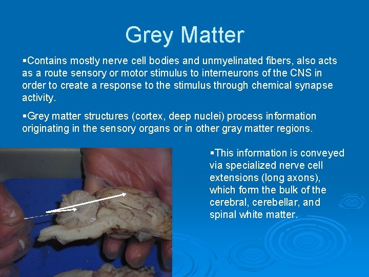 Grey Matter §Contains mostly nerve cell bodies and unmyelinated fibers, also acts as a