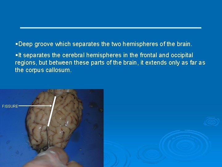 ____________ §Deep groove which separates the two hemispheres of the brain. §It separates the