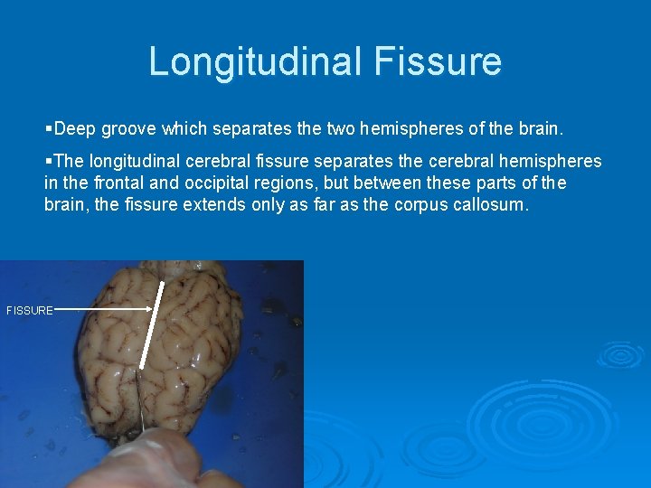 Longitudinal Fissure §Deep groove which separates the two hemispheres of the brain. §The longitudinal