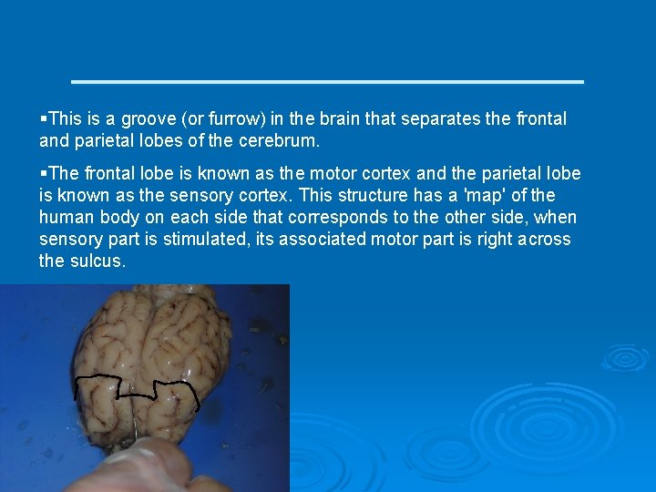 ____________ §This is a groove (or furrow) in the brain that separates the frontal