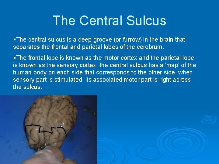 The Central Sulcus §The central sulcus is a deep groove (or furrow) in the