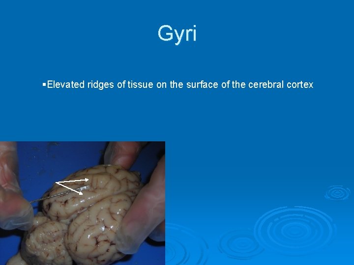 Gyri §Elevated ridges of tissue on the surface of the cerebral cortex 