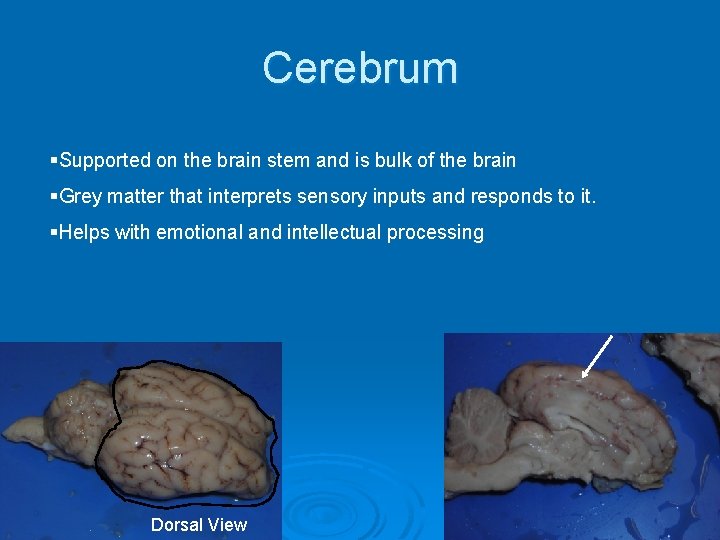 Cerebrum §Supported on the brain stem and is bulk of the brain §Grey matter