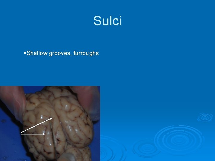 Sulci §Shallow grooves, furroughs 