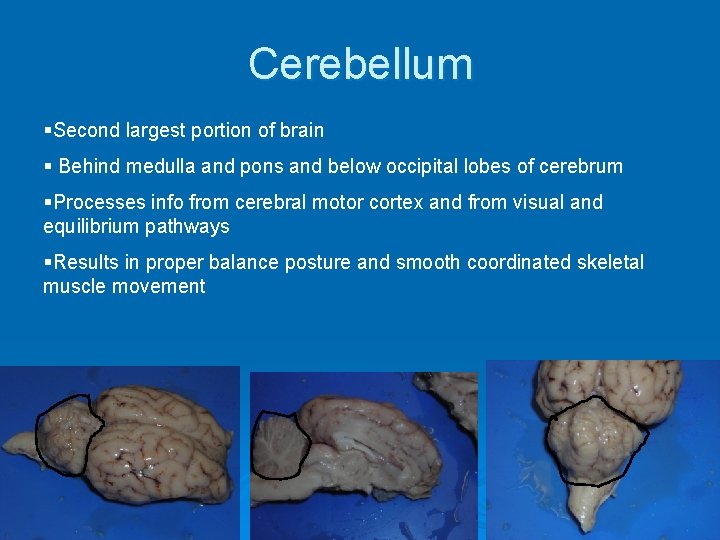 Cerebellum §Second largest portion of brain § Behind medulla and pons and below occipital