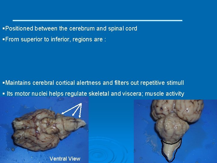 ____________ §Positioned between the cerebrum and spinal cord §From superior to inferior, regions are