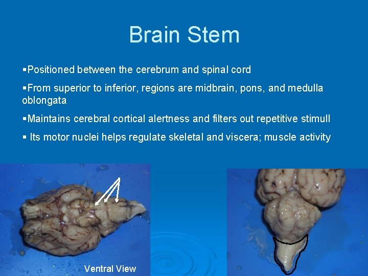 Brain Stem §Positioned between the cerebrum and spinal cord §From superior to inferior, regions