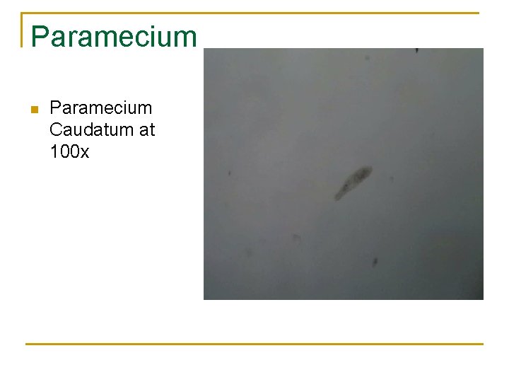 Paramecium n Paramecium Caudatum at 100 x 