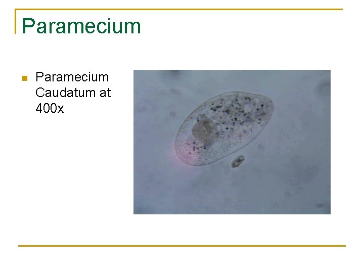 Paramecium n Paramecium Caudatum at 400 x 