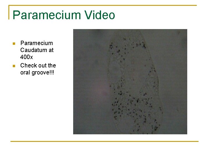 Paramecium Video n n Paramecium Caudatum at 400 x Check out the oral groove!!!