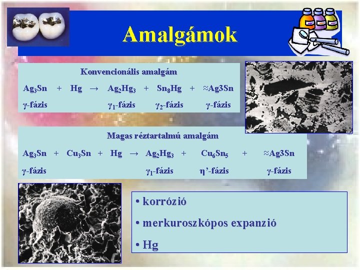 Amalgámok Konvencionális amalgám Ag 3 Sn γ-fázis + Hg → Ag 2 Hg 3