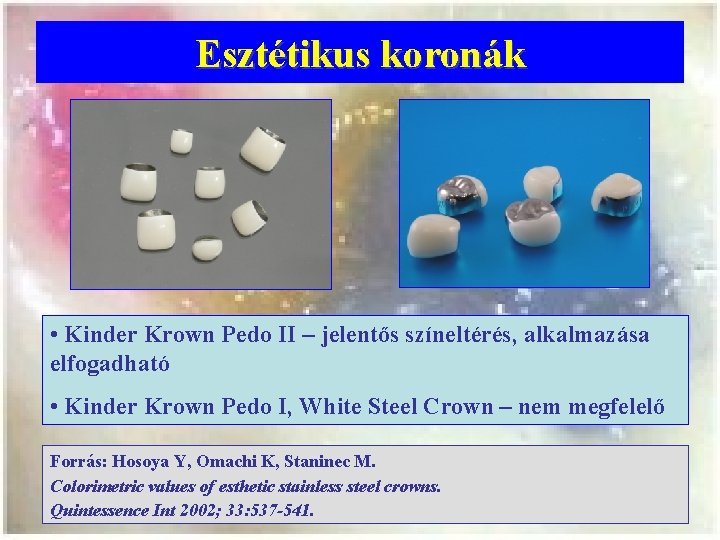 Esztétikus koronák • Kinder Krown Pedo II – jelentős színeltérés, alkalmazása elfogadható • Kinder