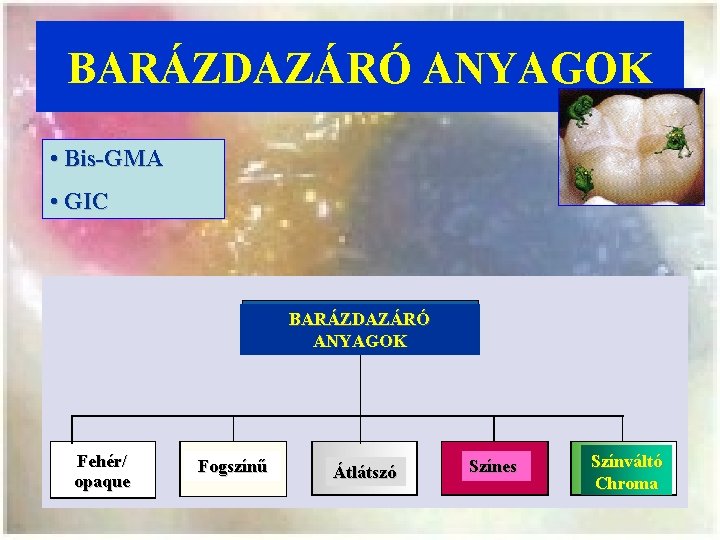 BARÁZDAZÁRÓ ANYAGOK • Bis-GMA • GIC BARÁZDAZÁRÓ ANYAGOK Fehér/ opaque Fogszínű Átlátszó Színes Színváltó