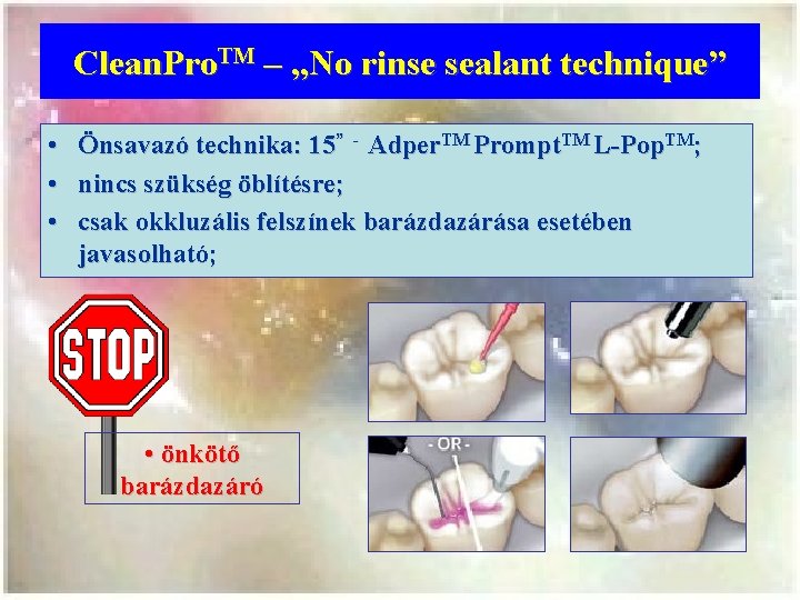 Clean. Pro. TM – „No rinse sealant technique” • • • Önsavazó technika: 15”