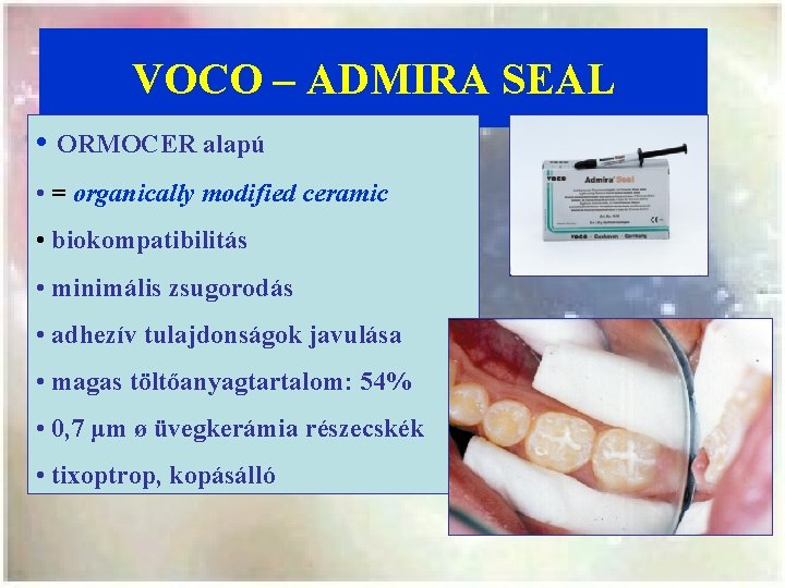 VOCO – ADMIRA SEAL • ORMOCER alapú • = organically modified ceramic • biokompatibilitás