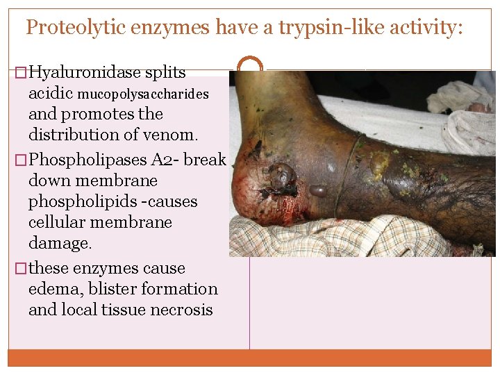 Proteolytic enzymes have a trypsin-like activity: �Hyaluronidase splits acidic mucopolysaccharides and promotes the distribution Proteolytic enzymes have a trypsin-like activity: �Hyaluronidase splits acidic mucopolysaccharides and promotes the distribution