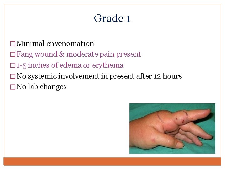 Grade 1 � Minimal envenomation � Fang wound & moderate pain present � 1 Grade 1 � Minimal envenomation � Fang wound & moderate pain present � 1