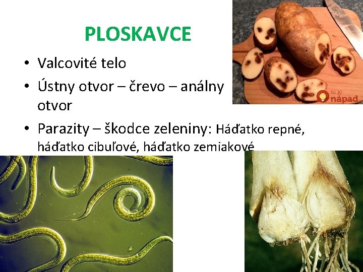 PLOSKAVCE • Valcovité telo • Ústny otvor – črevo – análny otvor • Parazity