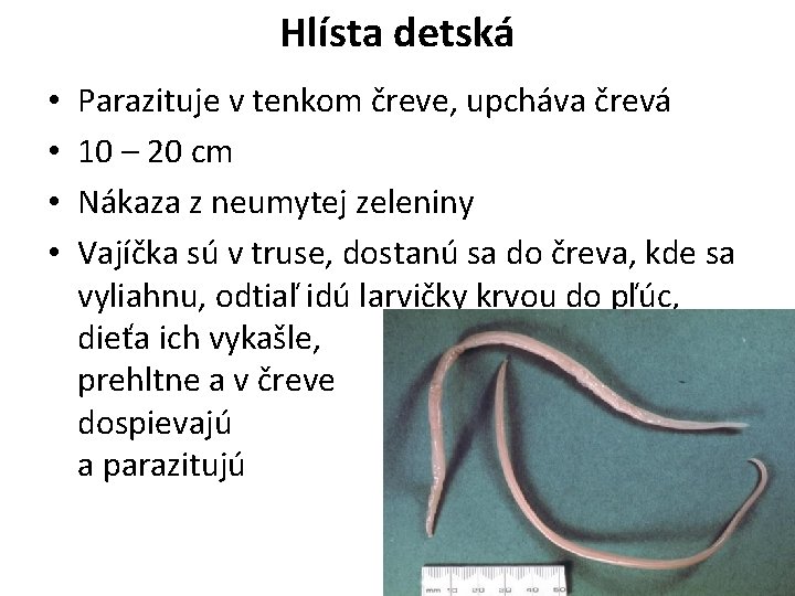 Hlísta detská • • Parazituje v tenkom čreve, upcháva črevá 10 – 20 cm
