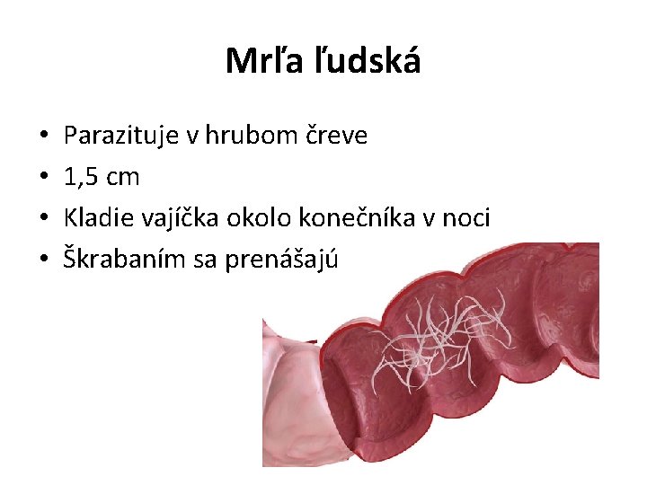 Mrľa ľudská • • Parazituje v hrubom čreve 1, 5 cm Kladie vajíčka okolo