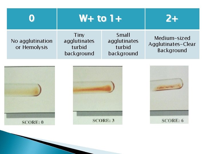0 No agglutination or Hemolysis W+ to 1+ Tiny agglutinates turbid background Small agglutinates