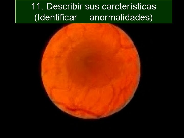 11. Describir sus carcterísticas (Identificar anormalidades) 