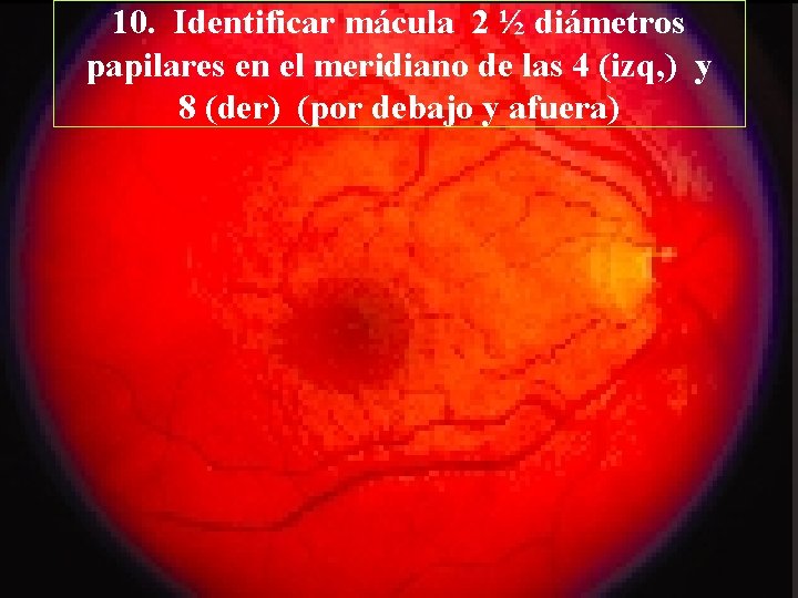 10. Identificar mácula 2 ½ diámetros papilares en el meridiano de las 4 (izq,