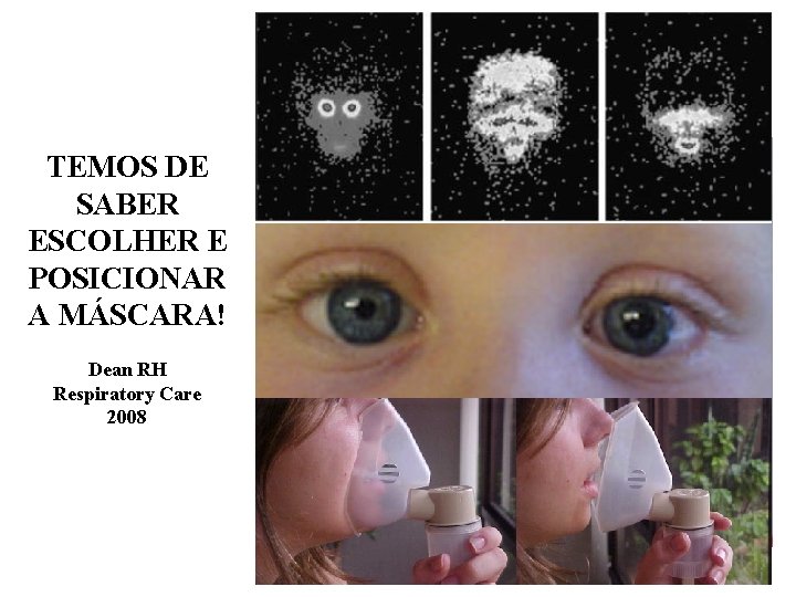 TEMOS DE SABER ESCOLHER E POSICIONAR A MÁSCARA! Dean RH Respiratory Care 2008 