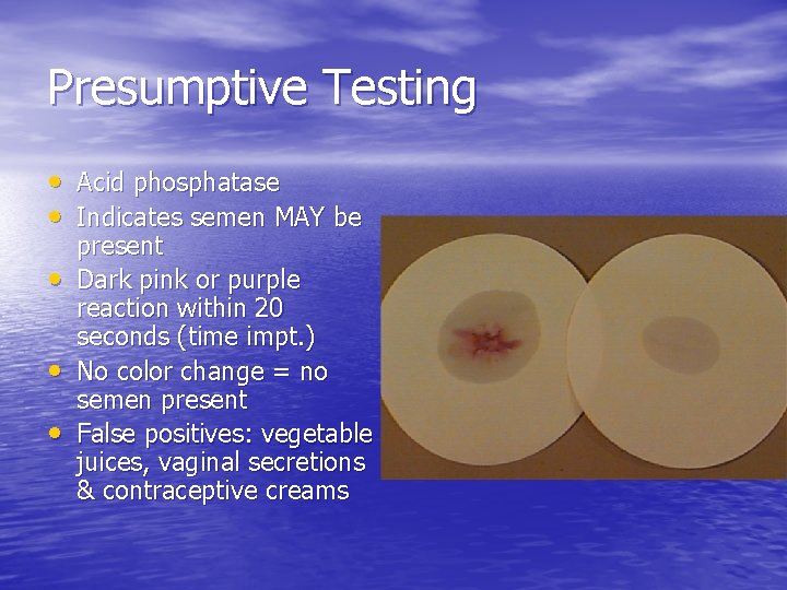 Presumptive Testing • Acid phosphatase • Indicates semen MAY be • • • present