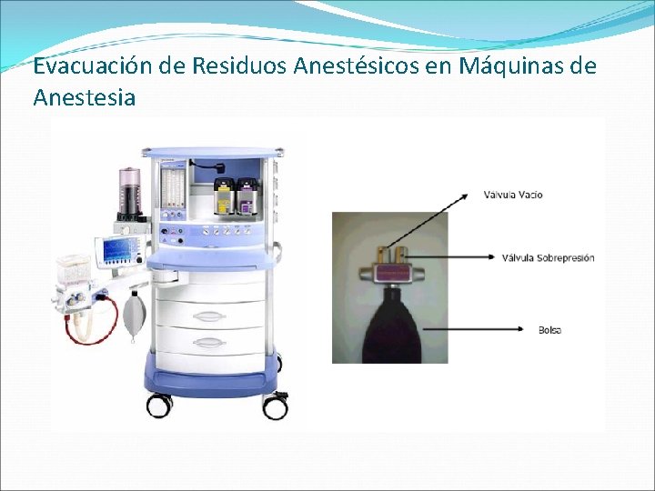 Evacuación de Residuos Anestésicos en Máquinas de Anestesia 