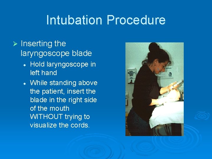 Intubation Procedure Ø Inserting the laryngoscope blade l l Hold laryngoscope in left hand