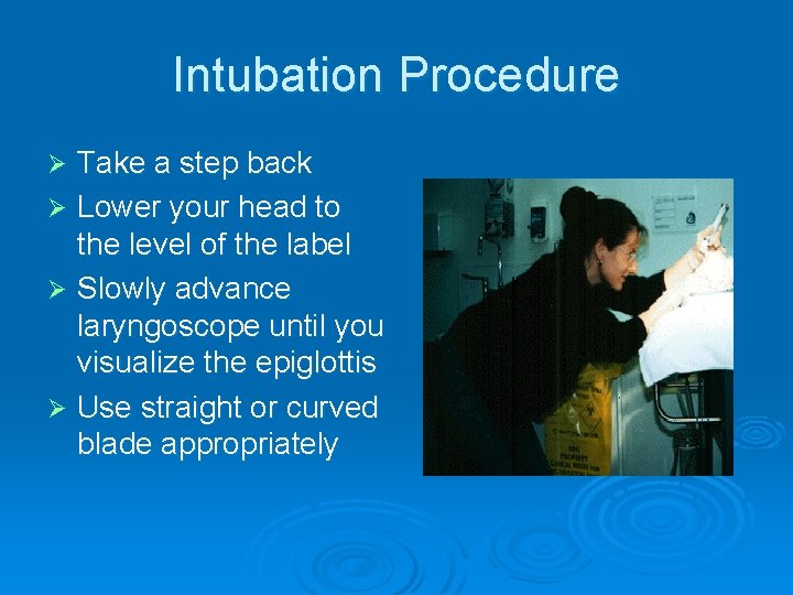 Intubation Procedure Take a step back Ø Lower your head to the level of