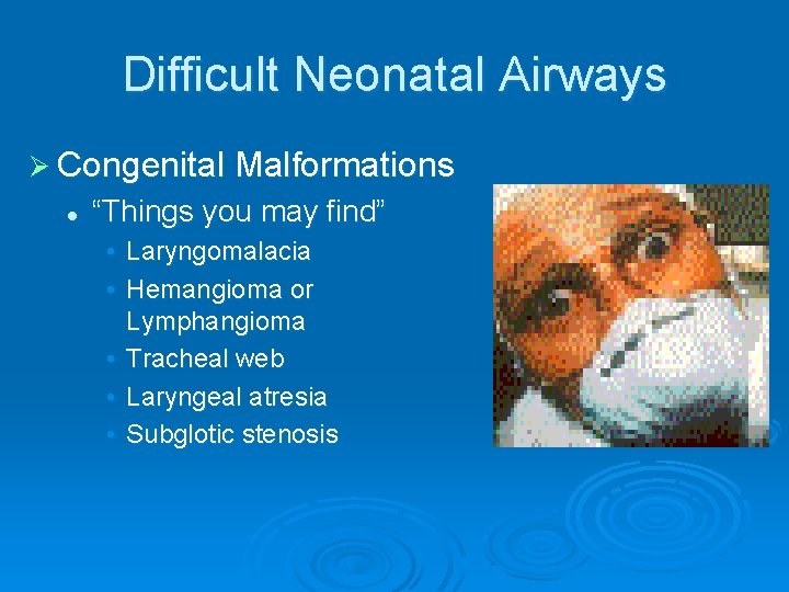 Difficult Neonatal Airways Ø Congenital Malformations l “Things you may find” • Laryngomalacia •
