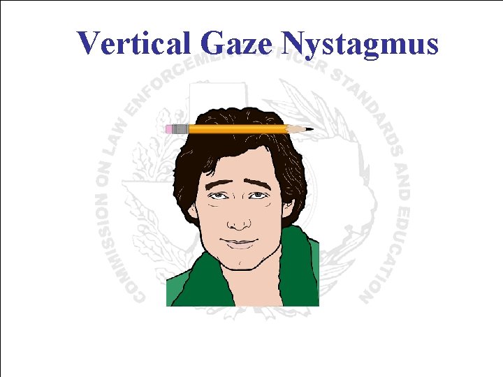 Vertical Gaze Nystagmus 