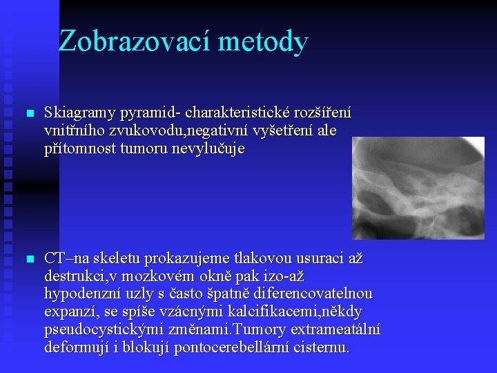 Zobrazovací metody n Skiagramy pyramid- charakteristické rozšíření vnitřního zvukovodu, negativní vyšetření ale přítomnost tumoru