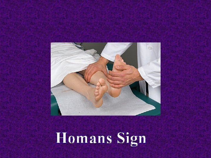 Homans Sign 