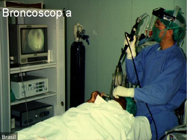 Broncoscopí Broncoscop a Brasil 16 