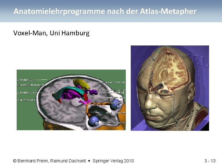 Anatomielehrprogramme nach der Atlas-Metapher Voxel-Man, Uni Hamburg © Bernhard Preim, Raimund Dachselt Springer Verlag