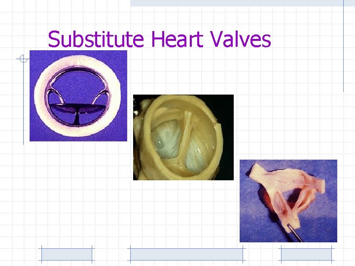 Substitute Heart Valves 