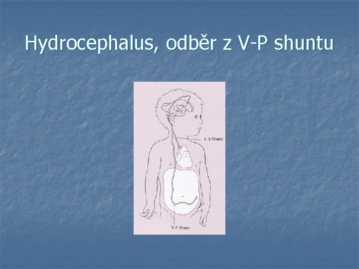 Hydrocephalus, odběr z V-P shuntu 