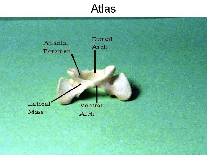 Atlas 