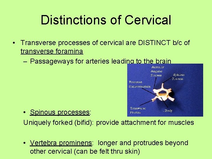 Distinctions of Cervical • Transverse processes of cervical are DISTINCT b/c of transverse foramina