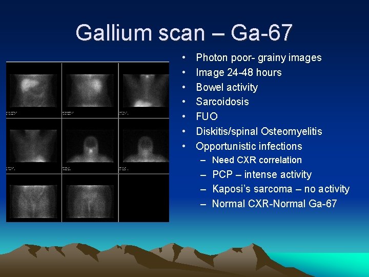 Gallium scan – Ga-67 • • Photon poor- grainy images Image 24 -48 hours